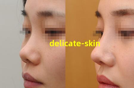 delicate-skin
