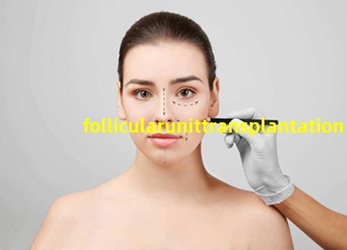 follicularunittransplantation.jpg