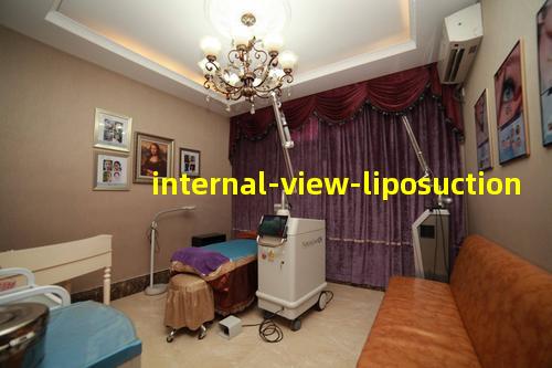 内窥镜无痕吸脂术的效果图