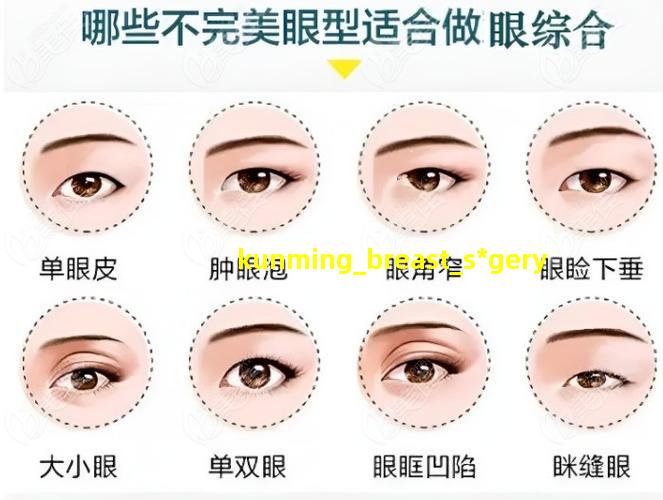 昆明胸部整形术图片