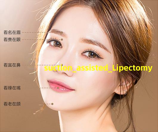 医院腹部吸脂手术