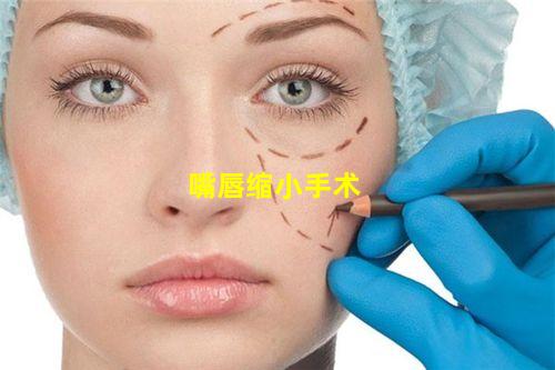 嘴唇缩小手术
