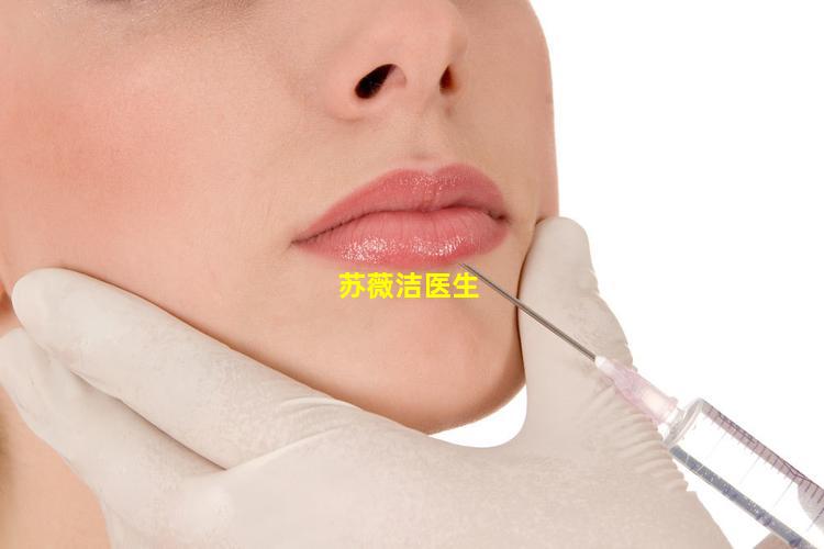 苏薇洁医生