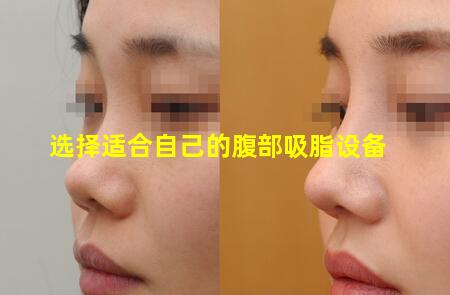 选择适合自己的腹部吸脂设备